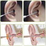 Premium 6 in 1 Ear Pick Cleaning Kit - Image 4
